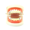 Hip hop style gold plated grillz set with AAA cubic zirconia on realistic dental model - Two-Tone Set