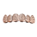 Rose gold hip hop grillz με μοναδική ανάγλυφη επιφάνεια και επικάλυψη 6 δοντιών - Πάνω Grillz / Ροζ χρυσό