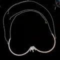 Detail of the elegant silver body chain featuring a sparkling rhinestone crown pendant - Crown Style / Silver