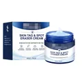 Crema botánica para eliminar acrocordones 50g con caja de embalaje azul de alta calidad - 50.00g
