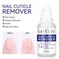 LILY'CUTE fast-acting nail cuticle remover liquid for manicure, 30ml dropper bottle - Nozzle Cuticle Remover (62648) / 30ml