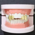 Vista detallada de colmillos de vampiro bañados en oro sobre un modelo dental. - Juego de Izquierda y Derecha / Dorado