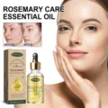 Huile essentielle de romarin WoodSleep 60ml soin visage hydratant extrait anti-acné sérum - 60ml