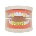 Detail view of gold hip-hop grillz with rhinestone inlay displayed on a standard dental model. - Full Set / Gold