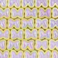 Cuentas sueltas lazo iridiscente de acrílico para joyería artesanal DIY collares - Púrpura