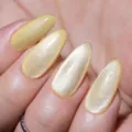 Goldenes Katzenauge (Y286)