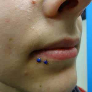 Close-up of blue opal labret studs worn on lower lip showing internal threading detail