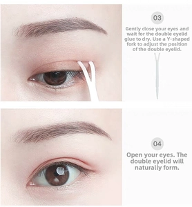 Macro view of Y-fork tool used for eyelids positioning and shaping steps 03 and 04