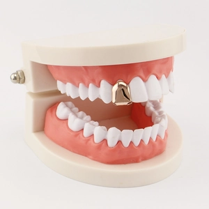 Detailed close-up of a 18K gold-plated vampire fang grillz on a white dental model
