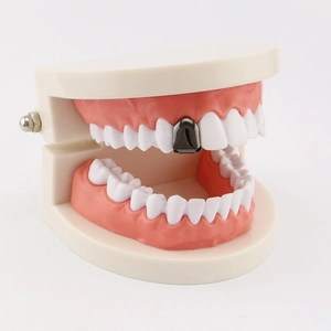 Detailed close-up of a gun black hip-hop single tooth cap on a dental model
