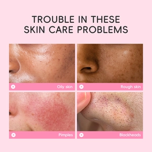 Laikou Sakura facial mask targets oily skin, rough texture, pimples, and blackheads effectively