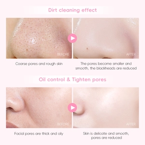Detail showing facial skin texture before and after using cherry blossom clay mask