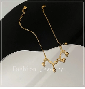 Detailed close-up of a gold crown anklet with geometric bars and polished metal beads
