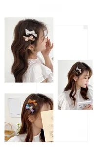 Detail shot of marble pattern acetate bow hair clips worn on side by a model
