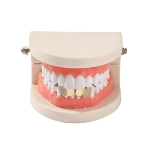 Macro-detail van vergulde hiphop grillz met zirkonia stenen op een gebitsmodel