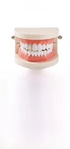 Detail of silver drop-shaped hip hop grillz with pavé zircon stones on dental model
