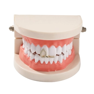 Single gold plated hollow drip grillz with iced out micro pavé crystals on a teeth model