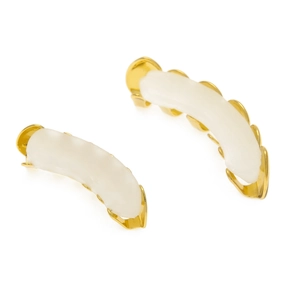 Detail view of gold-plated hip hop grillz with silicone molding bars for upper and lower teeth