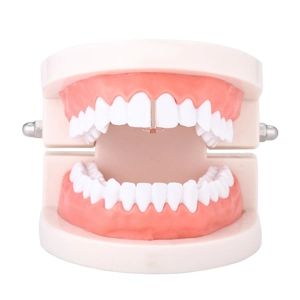 Macro view of a rose gold vertical bar tooth grill decor on a white dental model