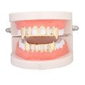 Λεπτομερής προβολή των χρυσών κοσμημάτων grillz σε μοντέλο προσομοιωτή ούλων