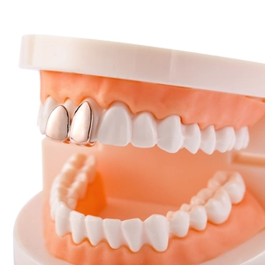 Vista macro di grillz a due denti in oro rosa su modello dentale per stile hip-hop