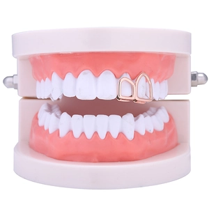 Gedetailleerde close-up van roségouden holle grillz voor twee tanden op een model