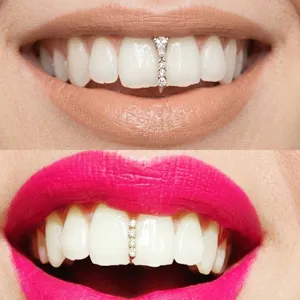 Primo piano di gemme dentali in zircone scintillante con design a goccia verticale