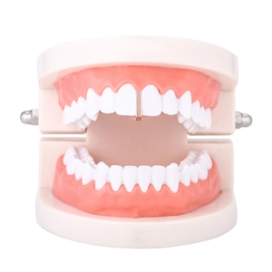 Macro detail of a dental model showing rose gold hip-hop tooth jewelry and metal grillz