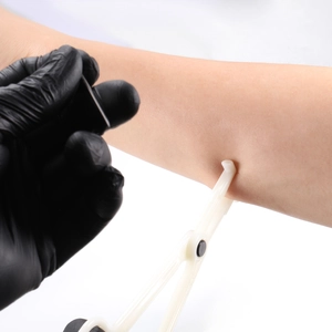 White body fat caliper measuring skinfold thickness on an arm with black gloves