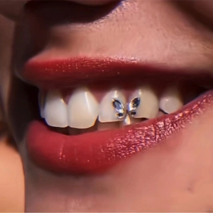 Marquise crystal tooth gems set in butterfly shape on teeth for beauty decoration