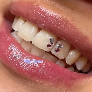 Pink and silver marquis crystal tooth gems arranged in a butterfly shape on front teeth