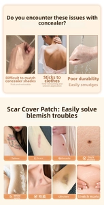 Waterproof ultra-thin skin concealer stickers for covering tattoos, scars and birthmarks