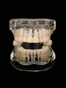 Macro-detail van gouden kruis-gebitsgrillz met zirkonia-stenen op een tandheelkundig model