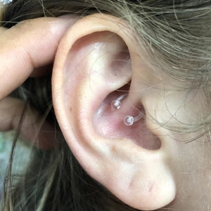 Macro view of a clear acrylic horseshoe barbell piercing worn on the daith of a human ear