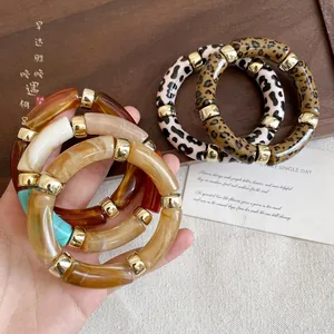 Close-up of vintage acrylic marbled and leopard print bracelets with gold spacers.
