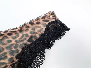 Detailed close-up showing leopard print mesh fabric and black floral lace trim on lingerie.