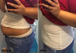 Comparaison avant et après d'une gaine amincissante blanche pour ventre plat femme.