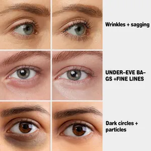 Before and after effect of eye brightening cream improving wrinkles and dark circles