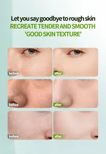 Before and after results showing pore shrinking and skin smoothing with soothing balm