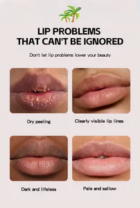 A detailed guide showing common lip issues including dryness, peeling, and visible lines.