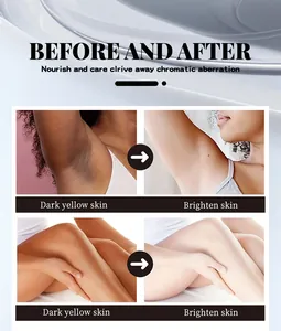 Before and after comparison of skin brightening cream for dark spots on armpits and legs.