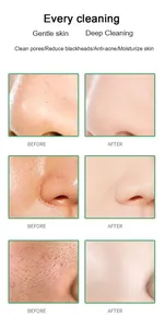 Detalle de comparación de piel antes y después mostrando efecto limpieza de mascarilla