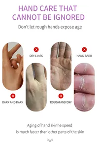 Visual guide to common hand skin issues including dry lines and rough skin textures