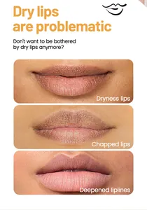 Detail showing different lip conditions like dryness and chapped lips for lip balm