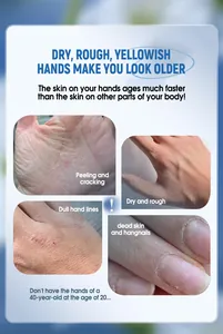 Detail image showing hand skin issues like dryness and cracking for hand cream.
