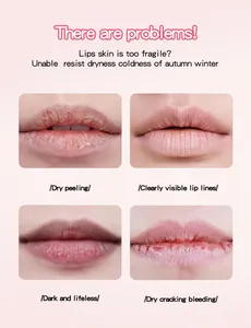 Detail view showing common lip concerns like dry peeling and cracking
