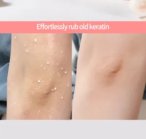 Visual comparison showing the effective exfoliating cream result on dry elbow skin