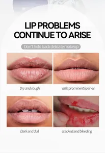 Detaillierte Darstellung häufiger Lippenprobleme wie Trockenheit, Fältchen und Mattigkeit.
