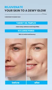 Before and after results showing clearer skin with salicylic acid cleanser