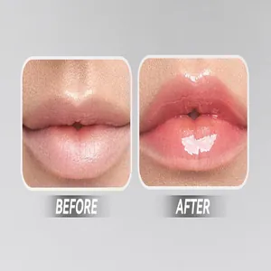 Bosuya Lippenöl Vorher-Nachher-Vergleich zeigt feuchtigkeitsspendende Wirkung